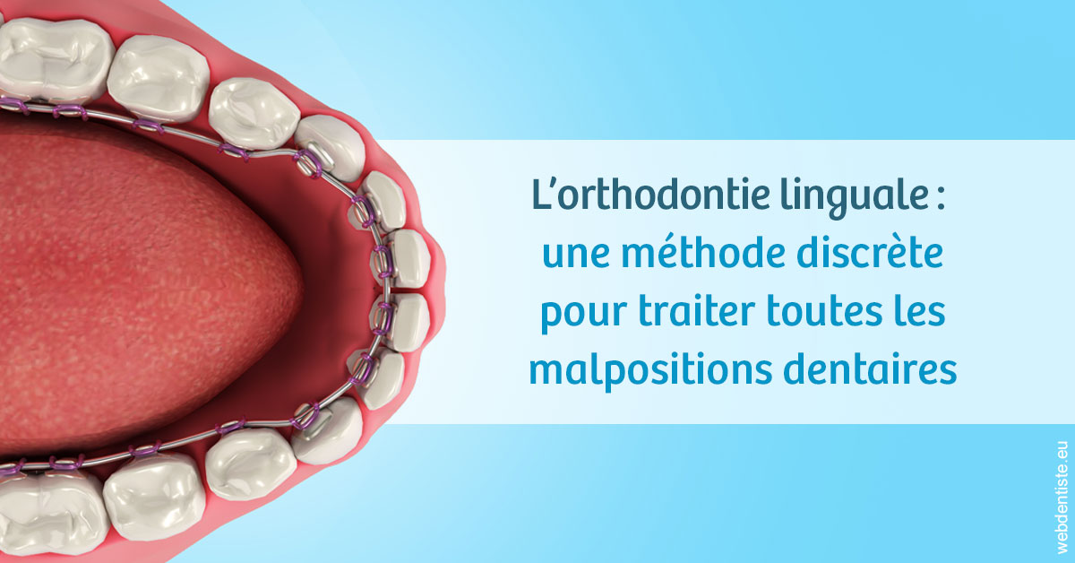 https://www.madentiste.paris/L'orthodontie linguale 1
