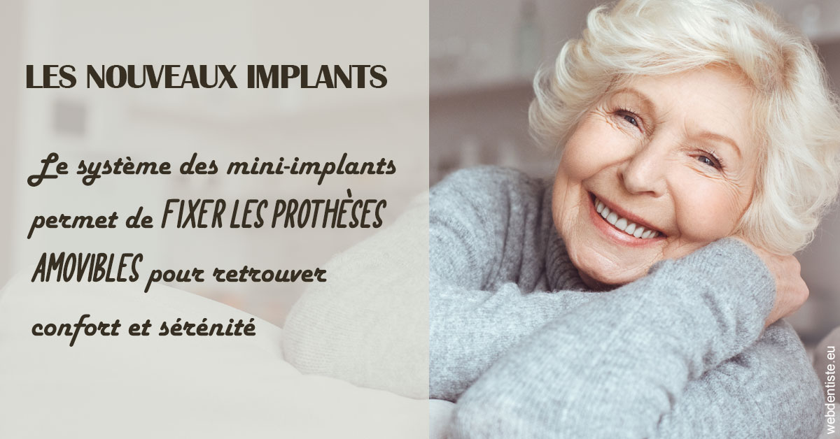 https://www.madentiste.paris/Les nouveaux implants 1