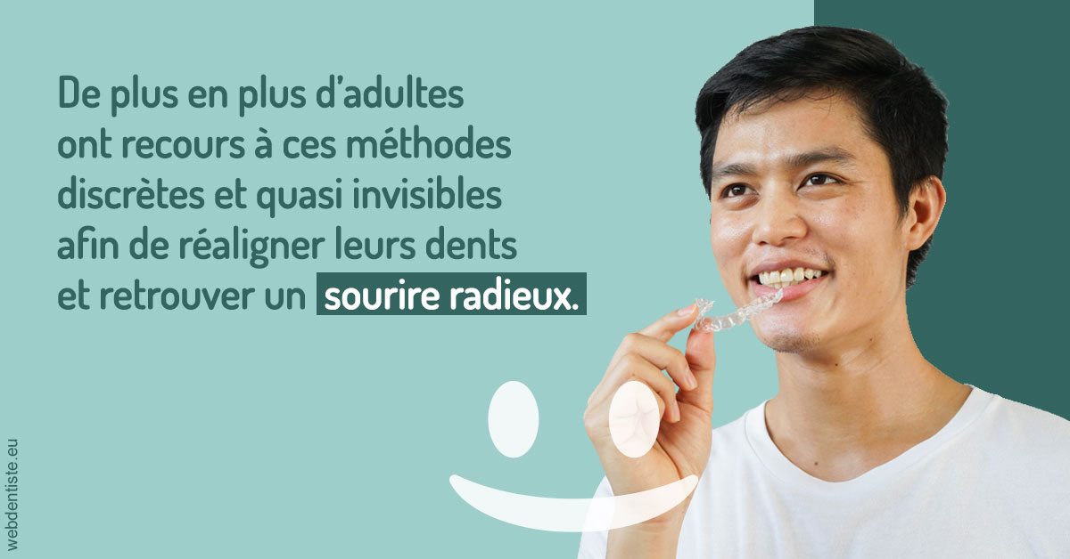 https://www.madentiste.paris/Gouttières sourire radieux 2