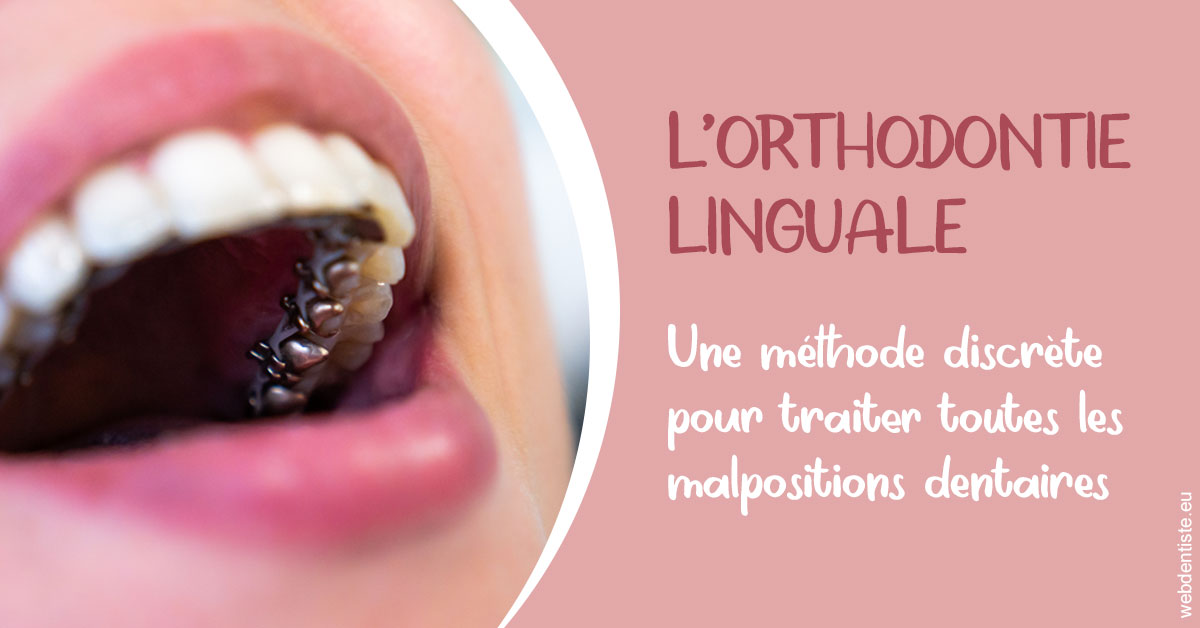 https://www.madentiste.paris/L'orthodontie linguale 2