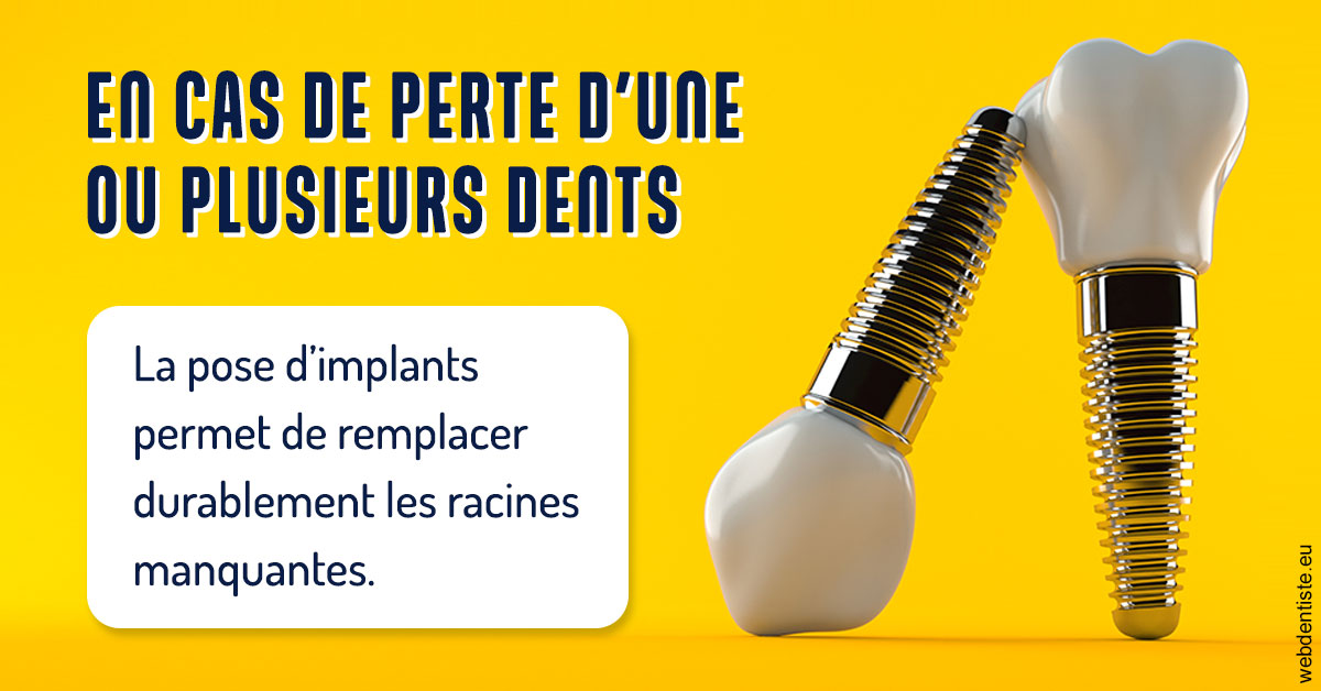 https://www.madentiste.paris/2024 T1 - Implants 02