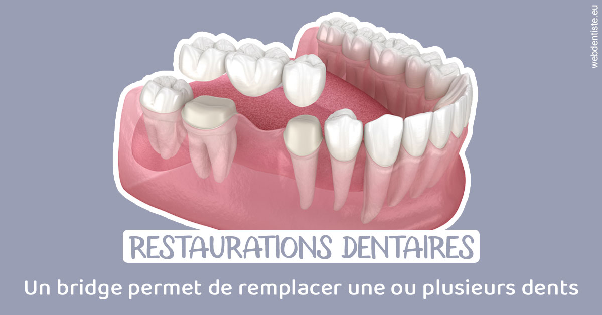 https://www.madentiste.paris/Bridge remplacer dents 1