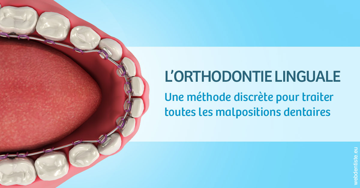 https://www.madentiste.paris/L'orthodontie linguale 1