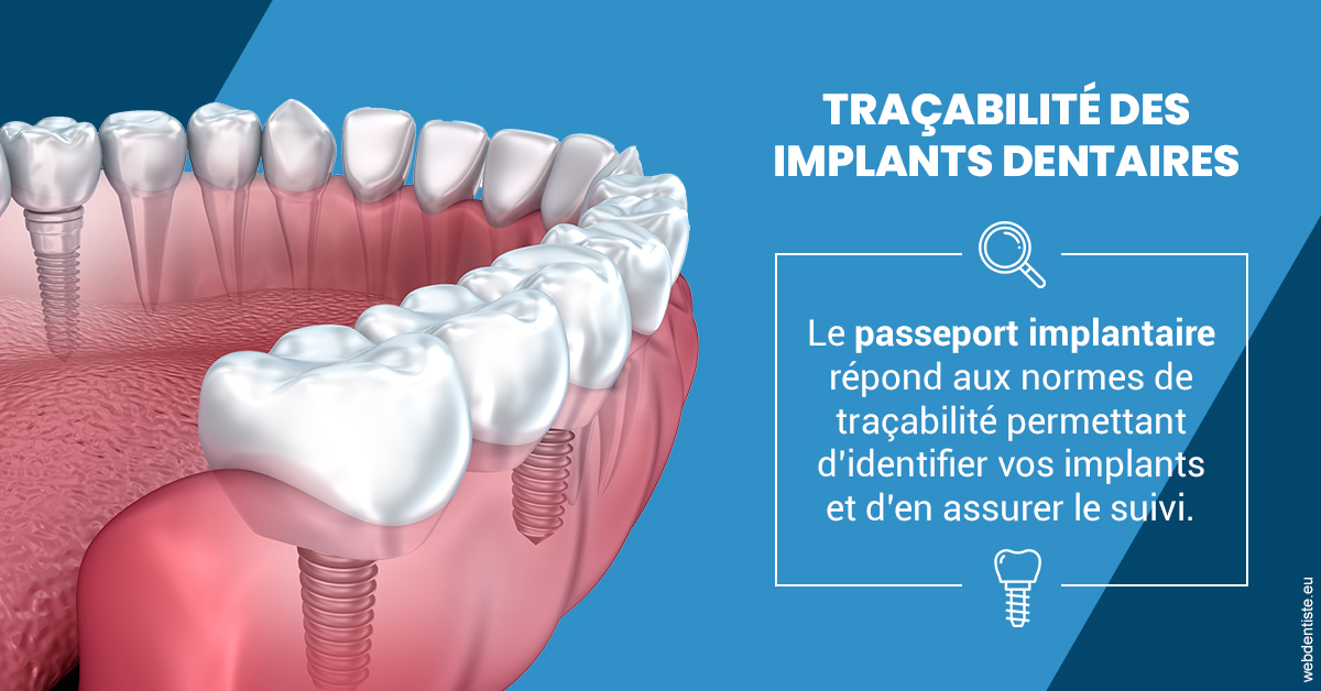 https://www.madentiste.paris/T2 2023 - Traçabilité des implants 1