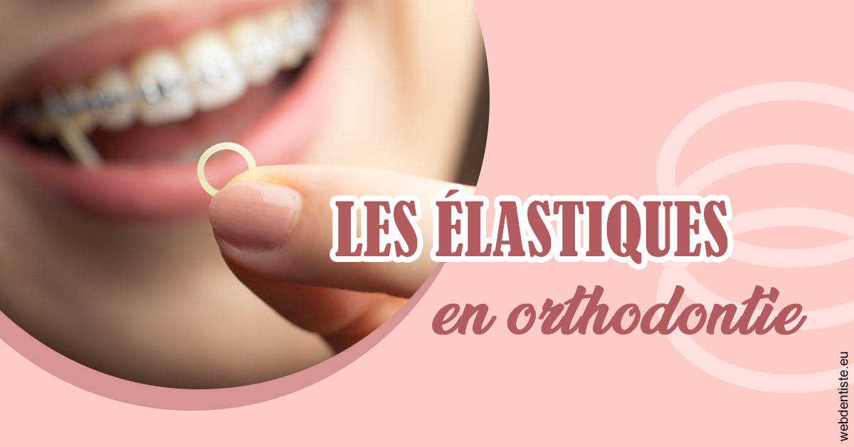 https://www.madentiste.paris/Elastiques orthodontie 1
