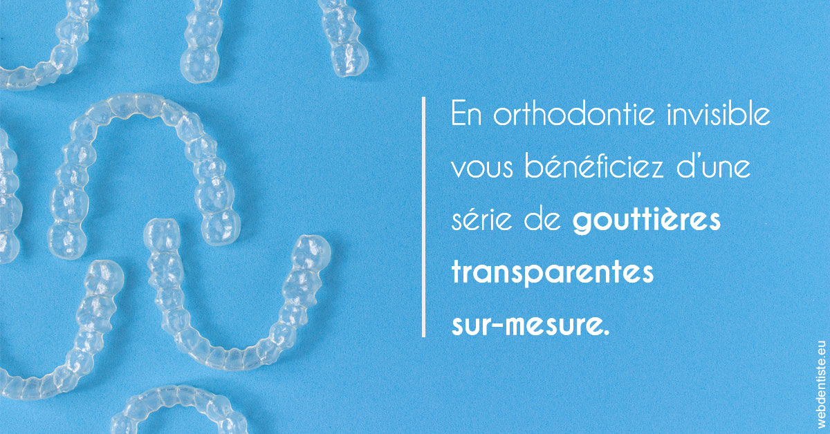 https://www.madentiste.paris/Orthodontie invisible 2