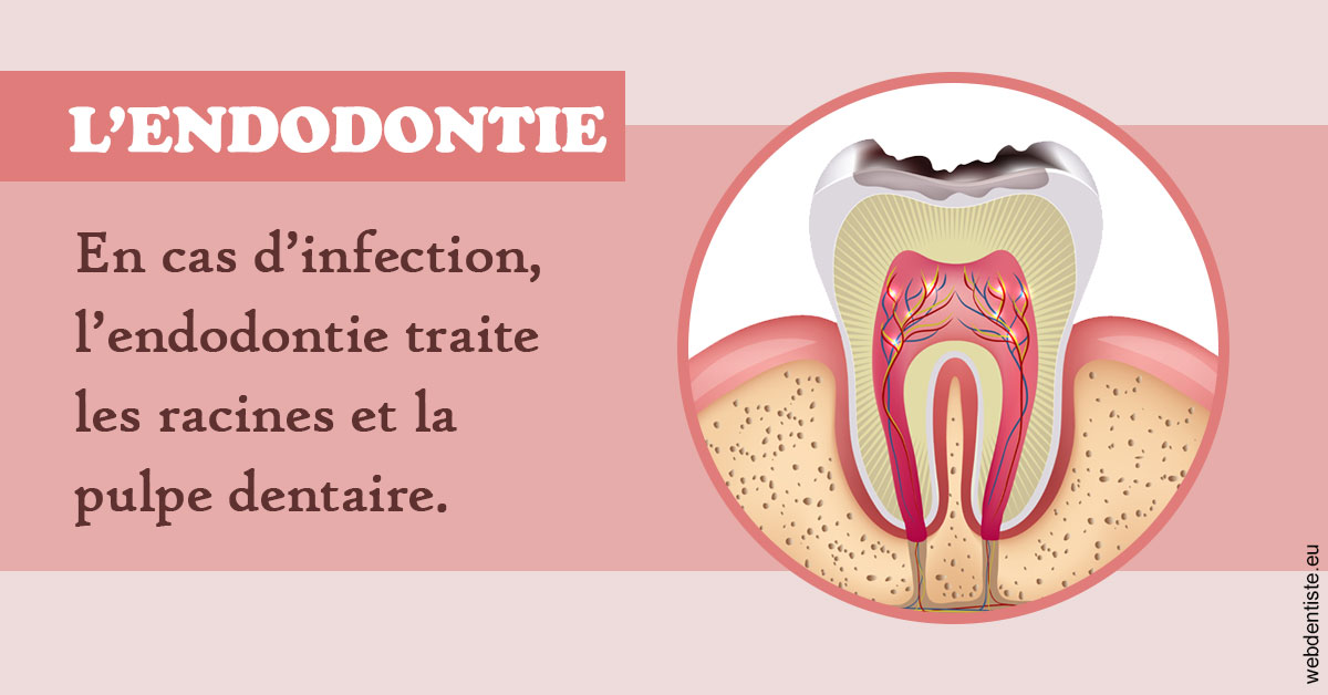 https://www.madentiste.paris/L'endodontie 2