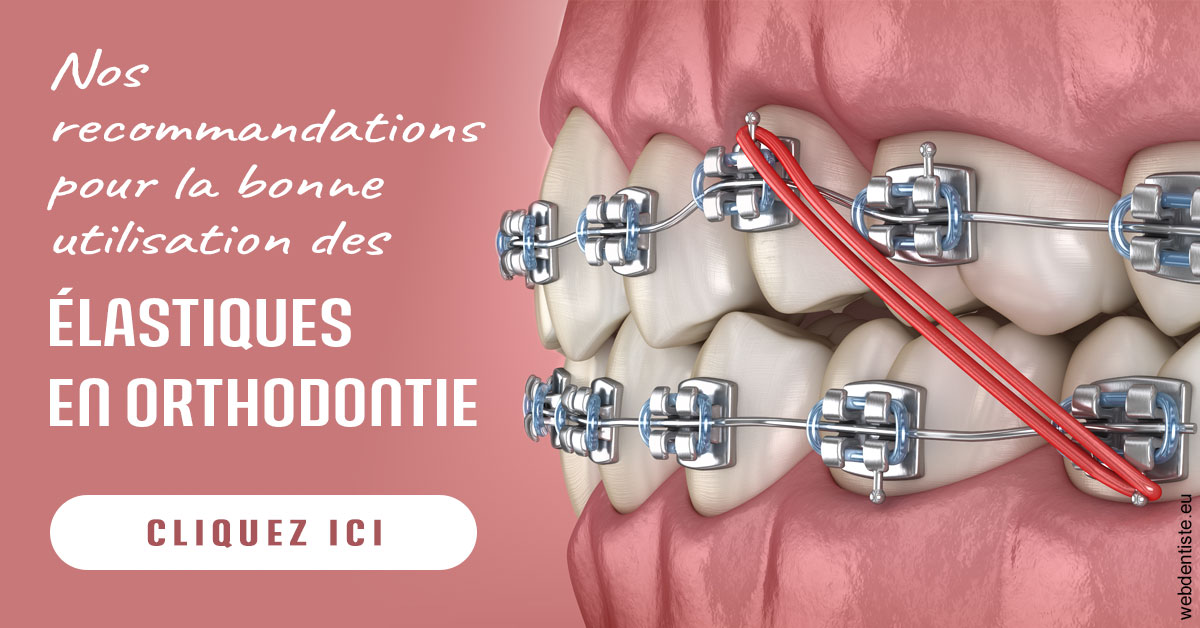 https://www.madentiste.paris/Elastiques orthodontie 2